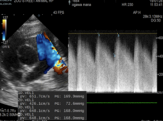 動脈管開存症 PDA動脈管開存症 PDA動脈管開存症 PDAイメージ1